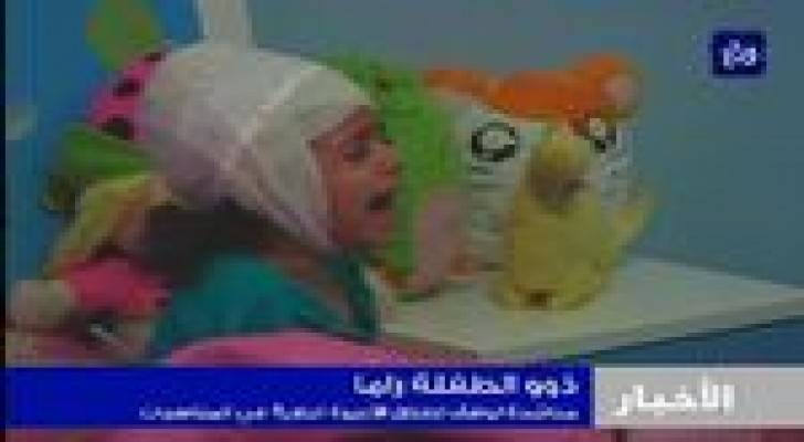 عيار ناري في عرس يصيب الطفلة راما سلمونة .. فيديو