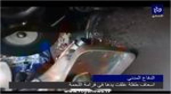 طفلة تفقد 4 اصابع من يدها في ماكنة " فرم اللحمة " .. فيديو