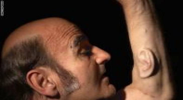 شاهد بالفيديو: فنان يزرع أذنا ثالثة بذراعه!