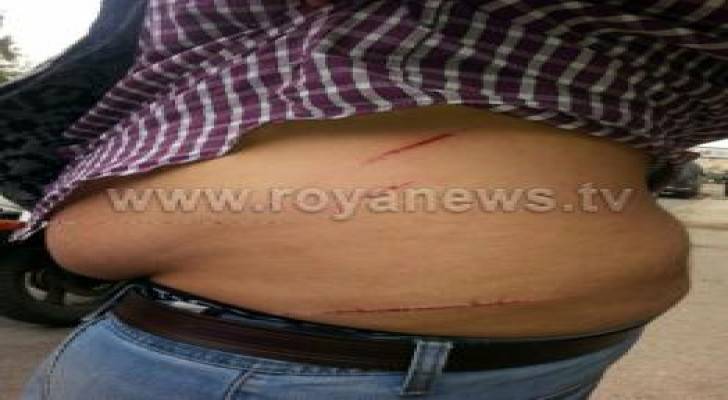 عمان: اصابة شخص اثر مشاجرة بالقرب من دوار الداخلية