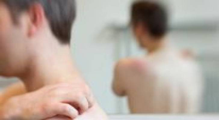 مجموعات البثور الصغيرة تنذر بالحزام الناري