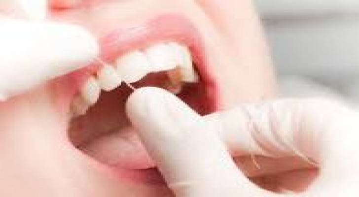 توصية بتنظيف الفراغات بين الأسنان مرة يوميا