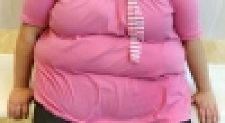 الملابس الفضفاضة تشجع على السمنة