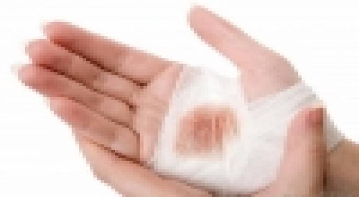 متى تستلزم الجروح استشارة الطبيب؟‬