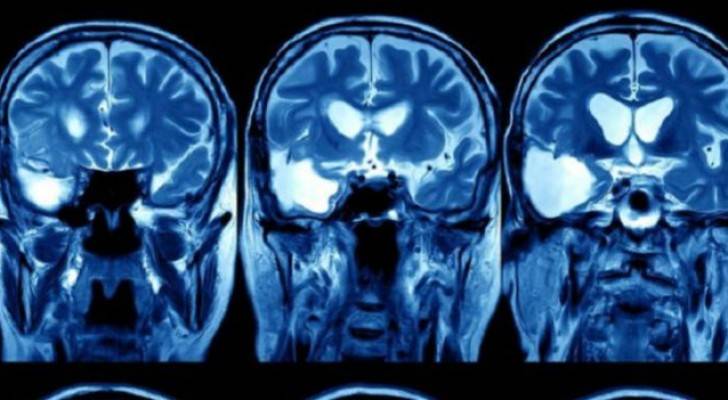 استخدام نظام الذكاء الصناعي لغوغل في علاج سرطان الرأس والعنق