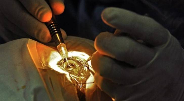 أول عملية جراحية ناجحة داخل العين باستخدام روبوت