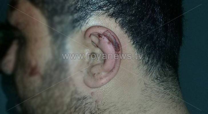 شابين يتعرضان للضرب والسلب بتهديد السلاح في اربد
