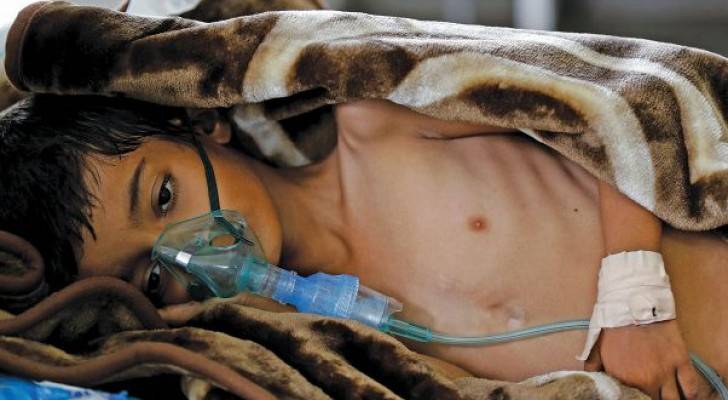 الأمم المتحدة: الكوليرا قد تعجل بحدوث مجاعة في اليمن