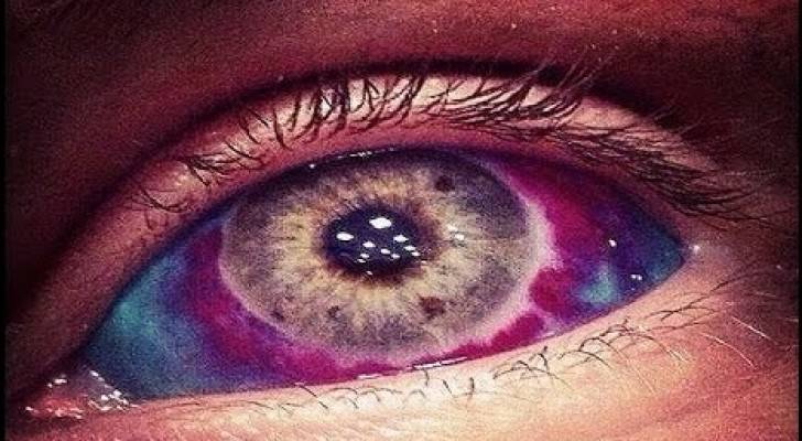 تعرضت امرأة الى مضاعفات خطيرة بعد أن خضعت باختيارها لوشم في مقلة العين