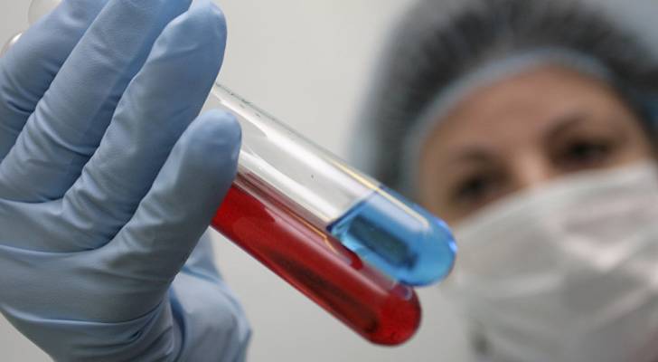 باحثون صينيون يطوّرون دواء ضد سلالات فيروس "الإيدز"