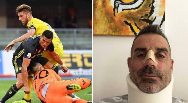 ستيفانو سورينتينو حارس نادي كييفو فيرونا الإيطالي