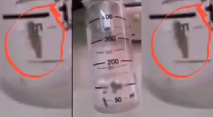 فيديو متداول لـ "صرصور" داخل جهاز تنفس في مستشفى حكومي