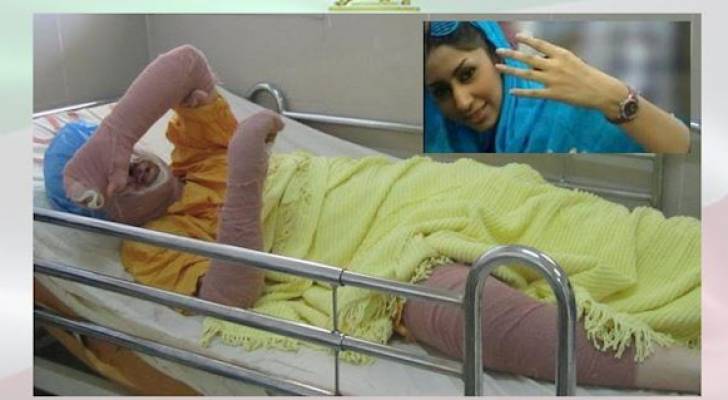 رحيل فتاة إيران الزرقاء.. مضرمة النار بجسدها تلفظ أنفاسها