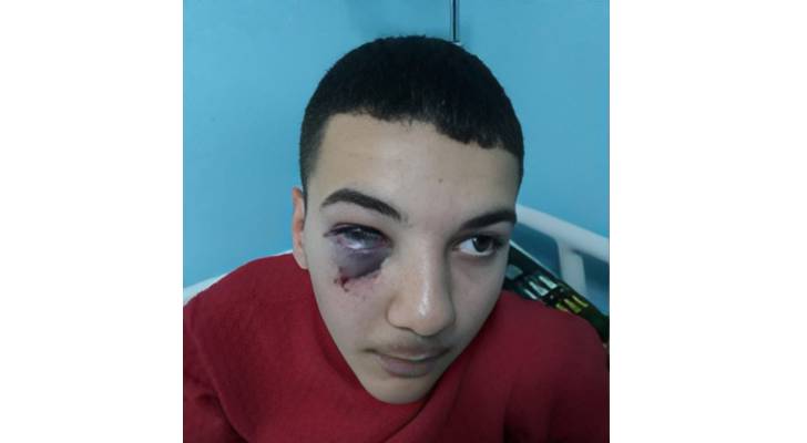 الطالب المعتدى عليه من قبل معلم في عجلون