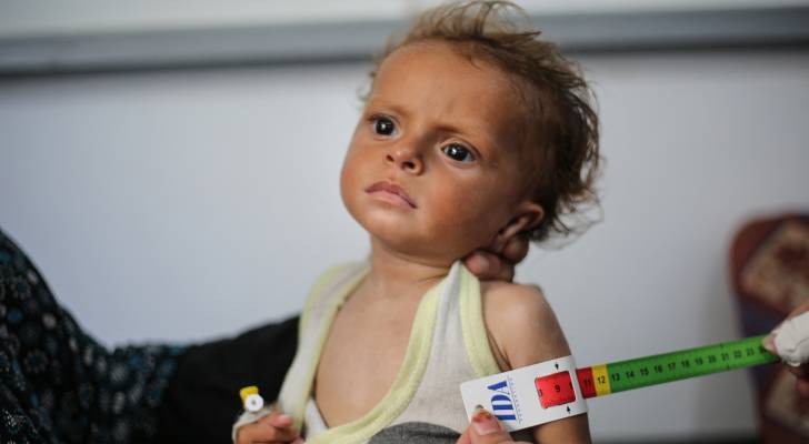 مدير مجمع الشفاء الطبي: الوضع الصحي في غزة كارثي والمنظومة منهارة
