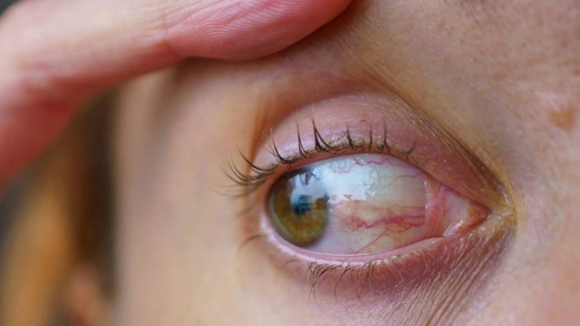 كيف تحمي عينيك من الإجهاد البصري في فصل الخريف؟