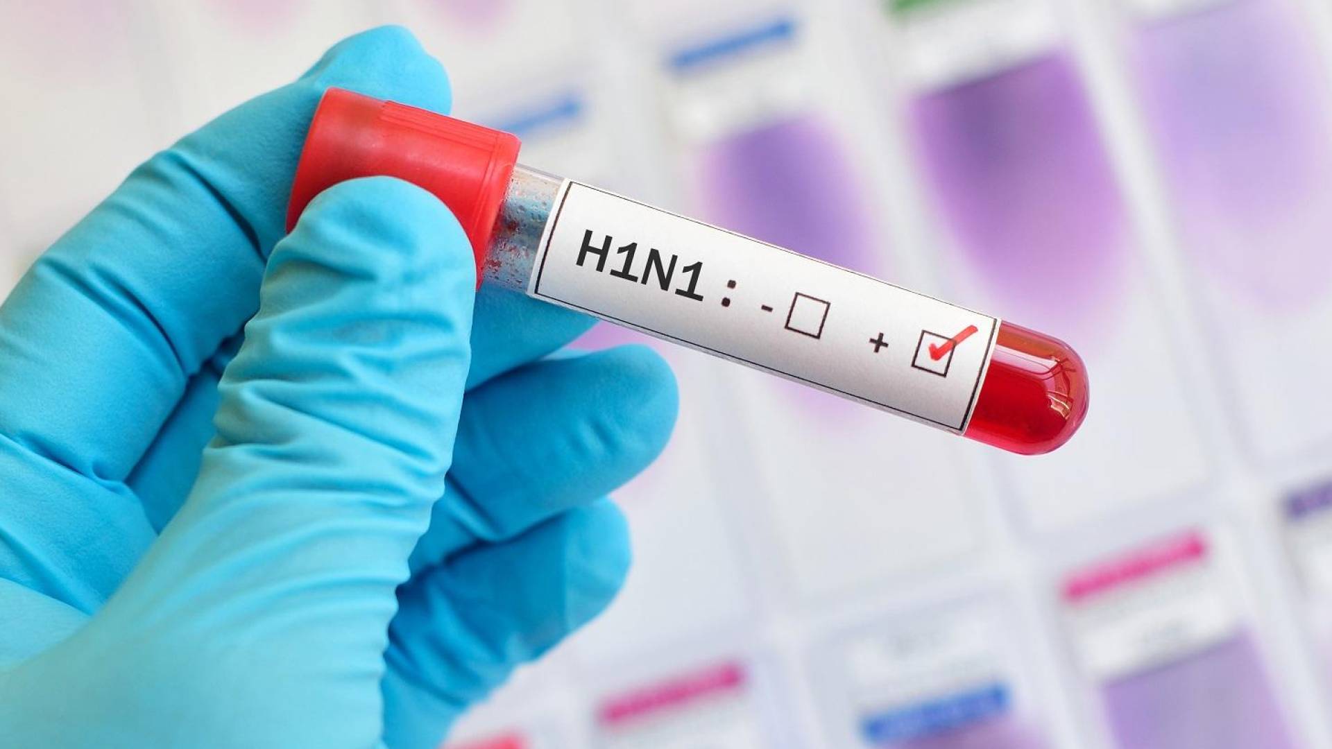 إسبانيا تسجل أول إصابة بإنفلونزا الخنازير الأفريقية قرب برشلونة