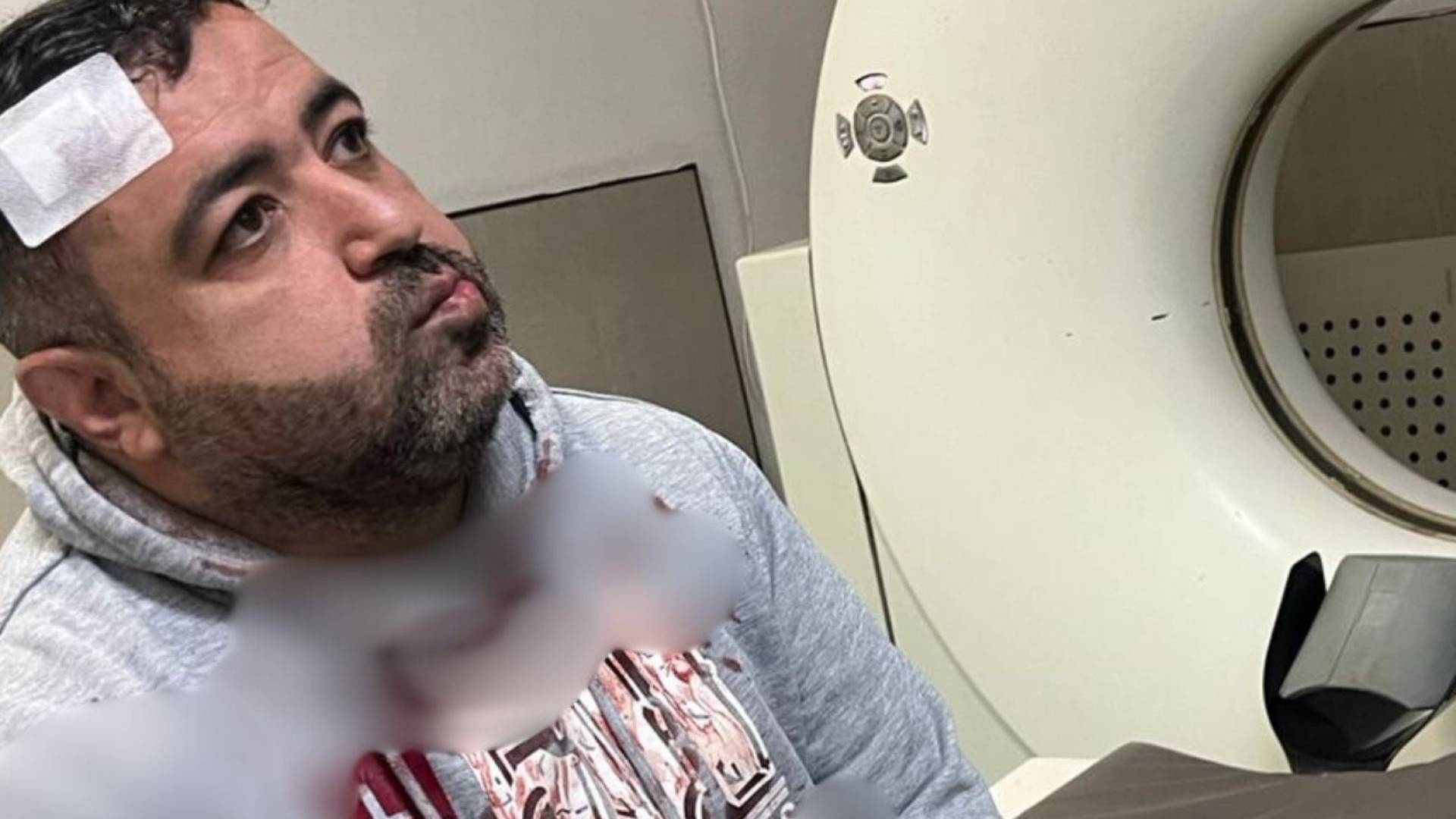 الاعتداء على الصحفي فيصل التميمي أمام منزله من قبل مجهولين.. فيديو