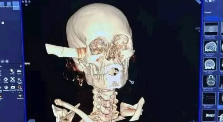 جمجمة