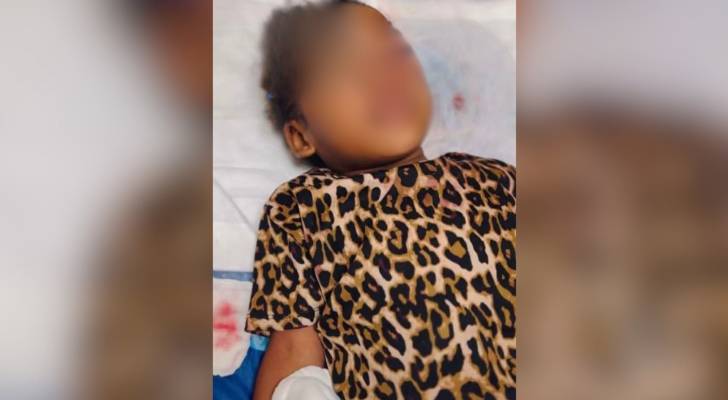 طفلة تعرضت لإصابة بالغة بسبب كلاب ضالة