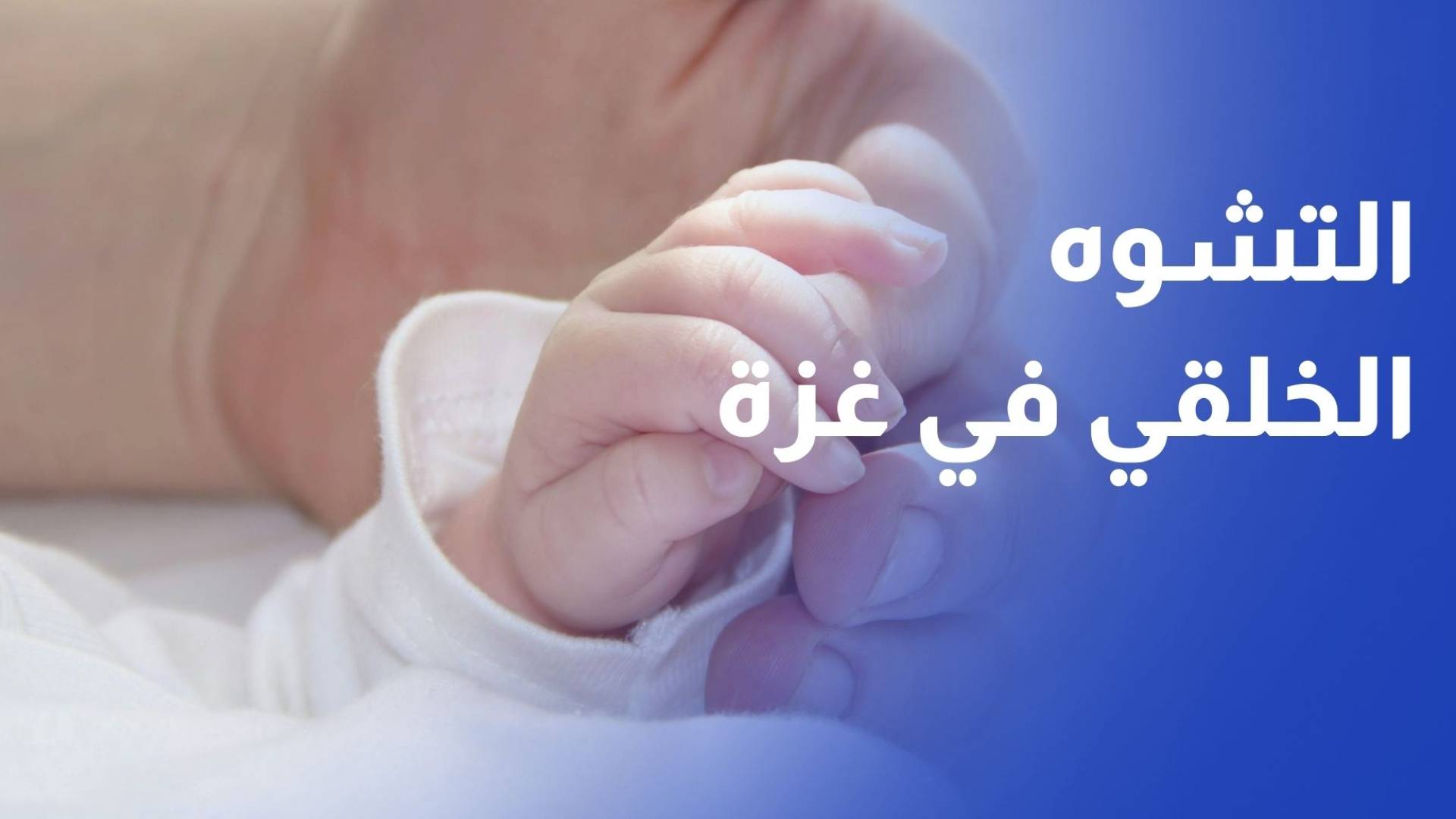 ارتفاع حالات التشوه الخلقي في القطاع