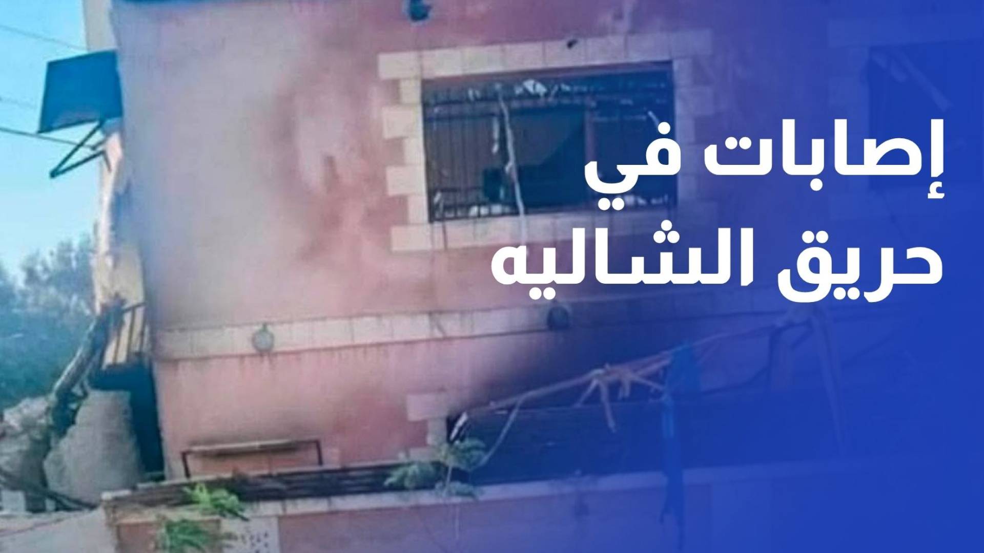 إصابة 8 أشخاص نتيجة حريق اندلع في شاليه بالشونة الشمالية