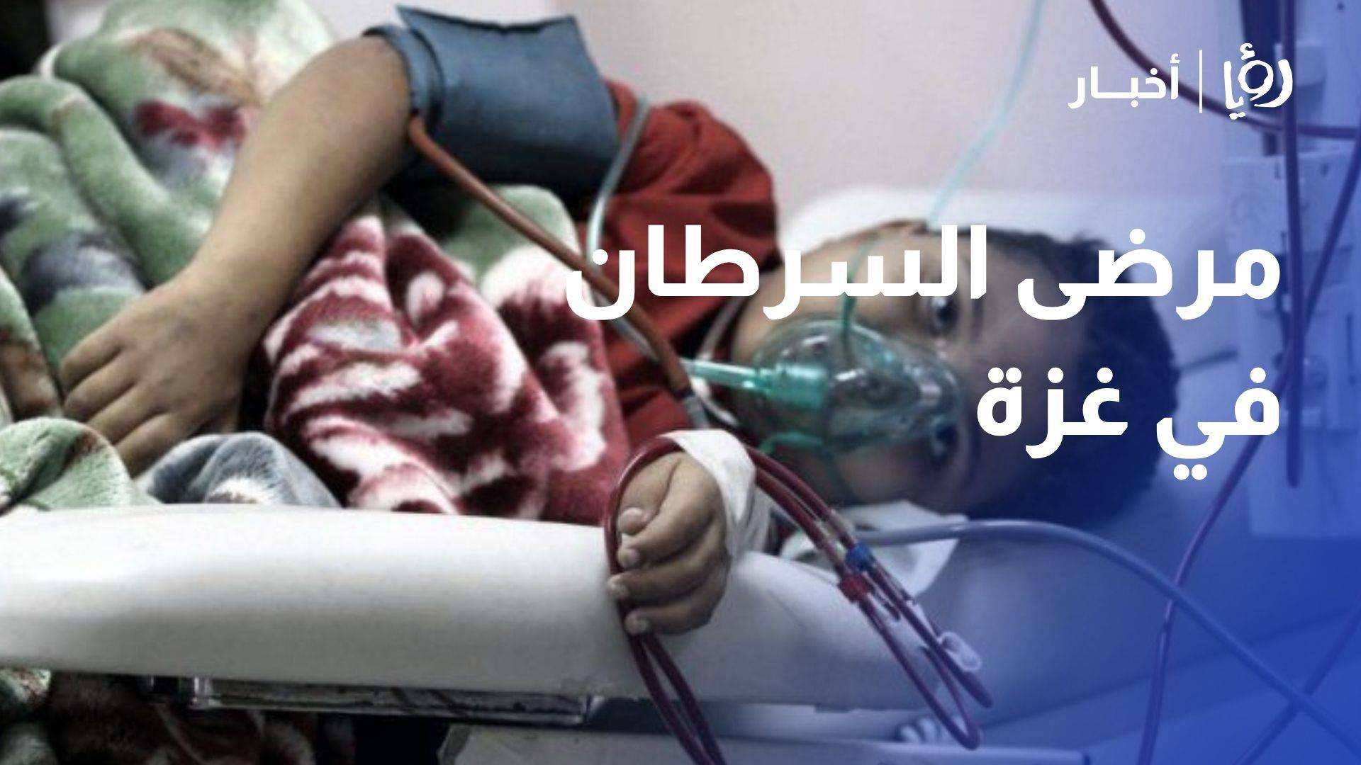 مرضى السرطان في غزة.. رحلة علاج تتوقف عند نقص الدواء وإغلاق المعابر