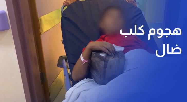 هجوم كلب ضال ينتهي ببتر إصبع طفل وسط تصاعد شكاوى