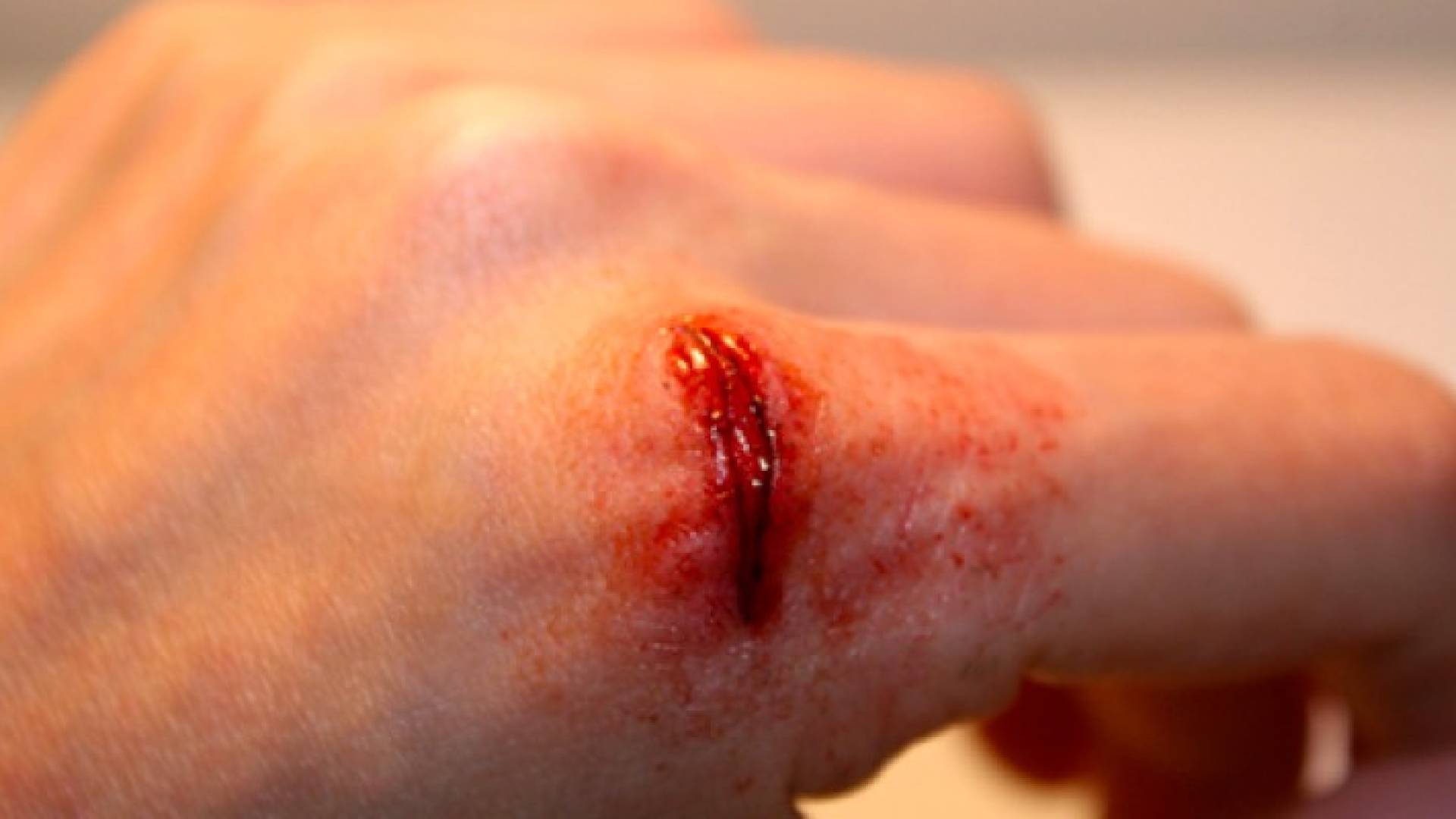 Image 1 from gallery