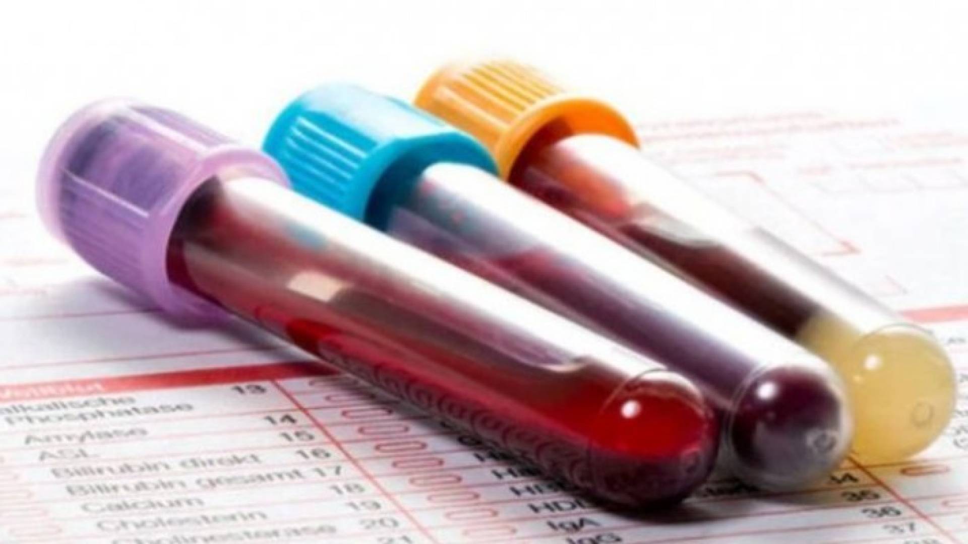 Image 1 from gallery