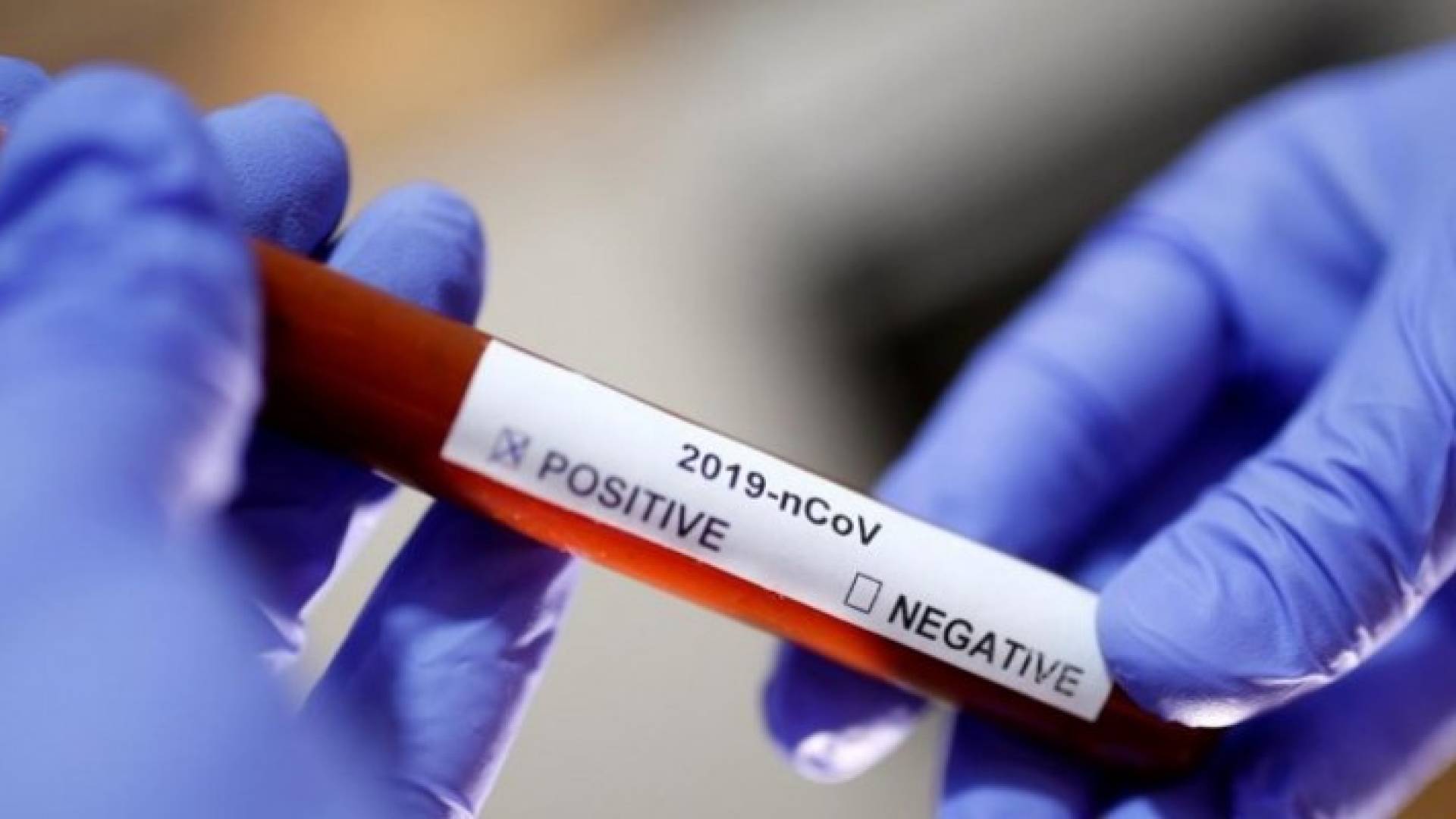 Image 1 from gallery