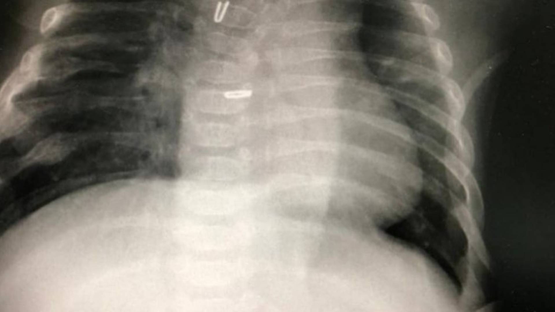 Image 1 from gallery