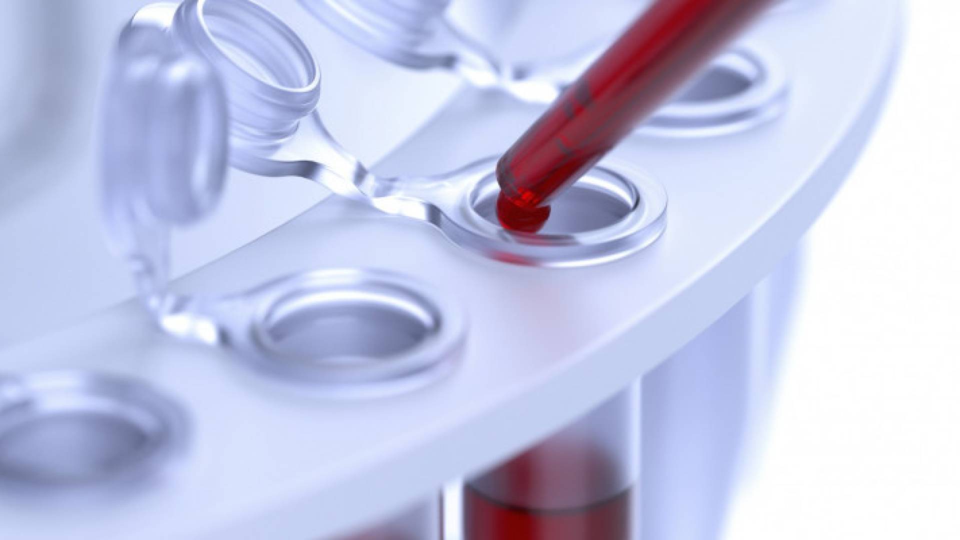 Image 1 from gallery