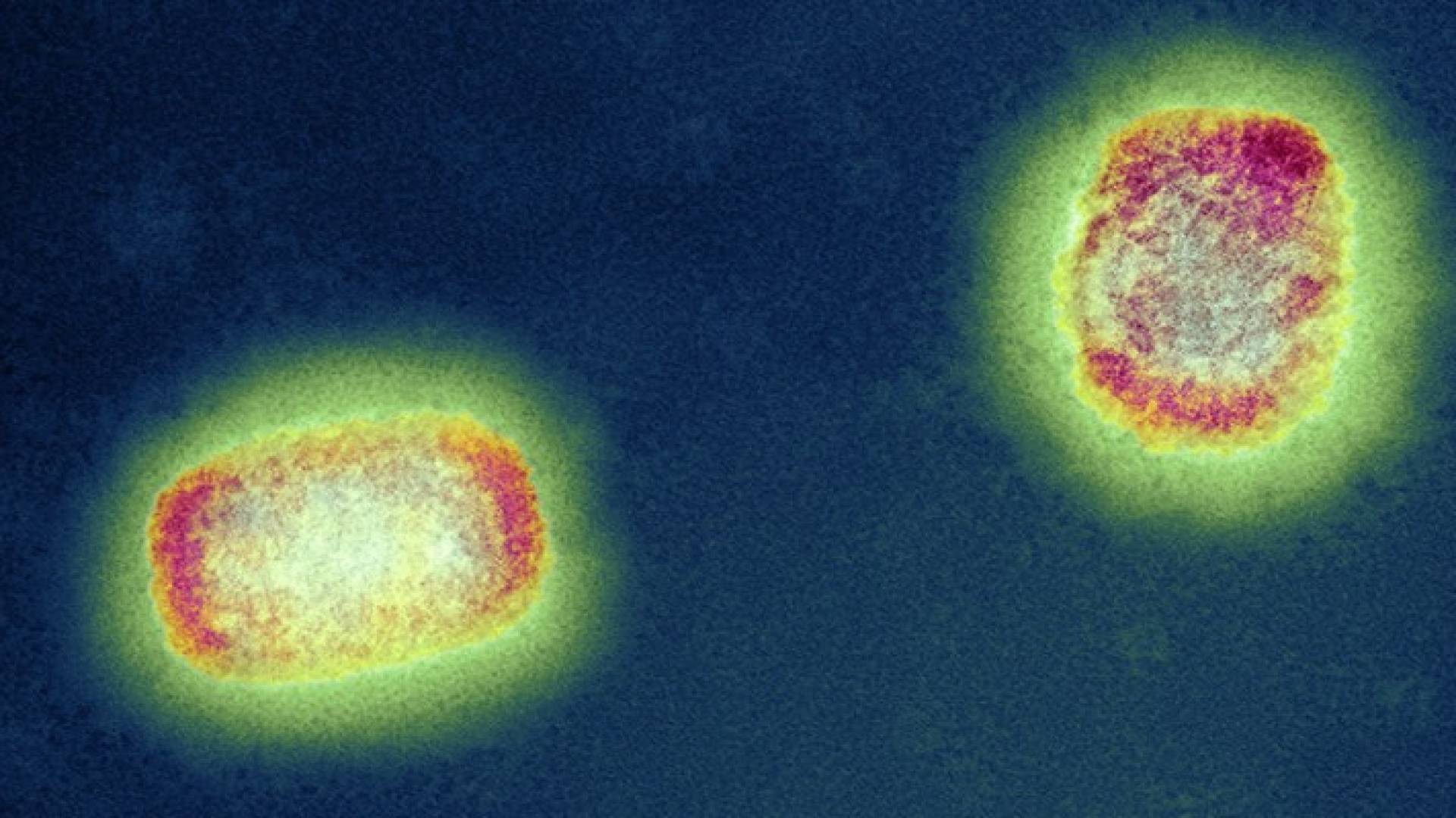 Image 1 from gallery