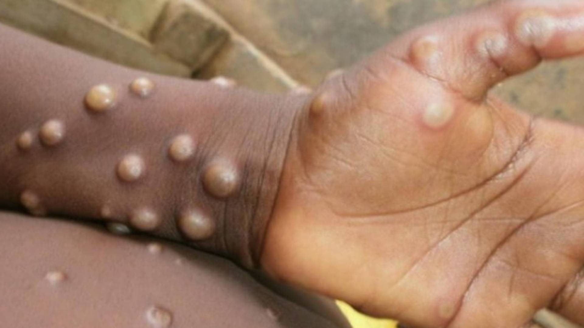 Image 1 from gallery