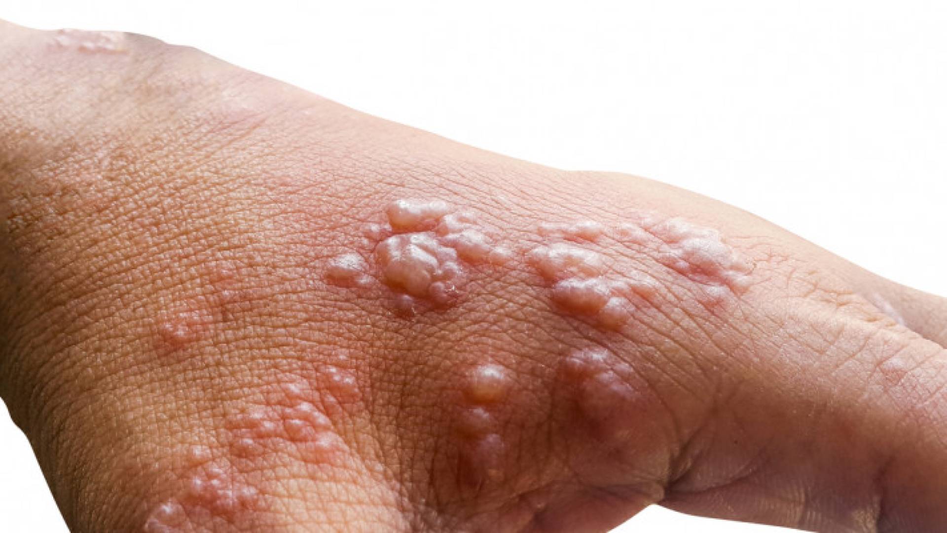 Image 1 from gallery