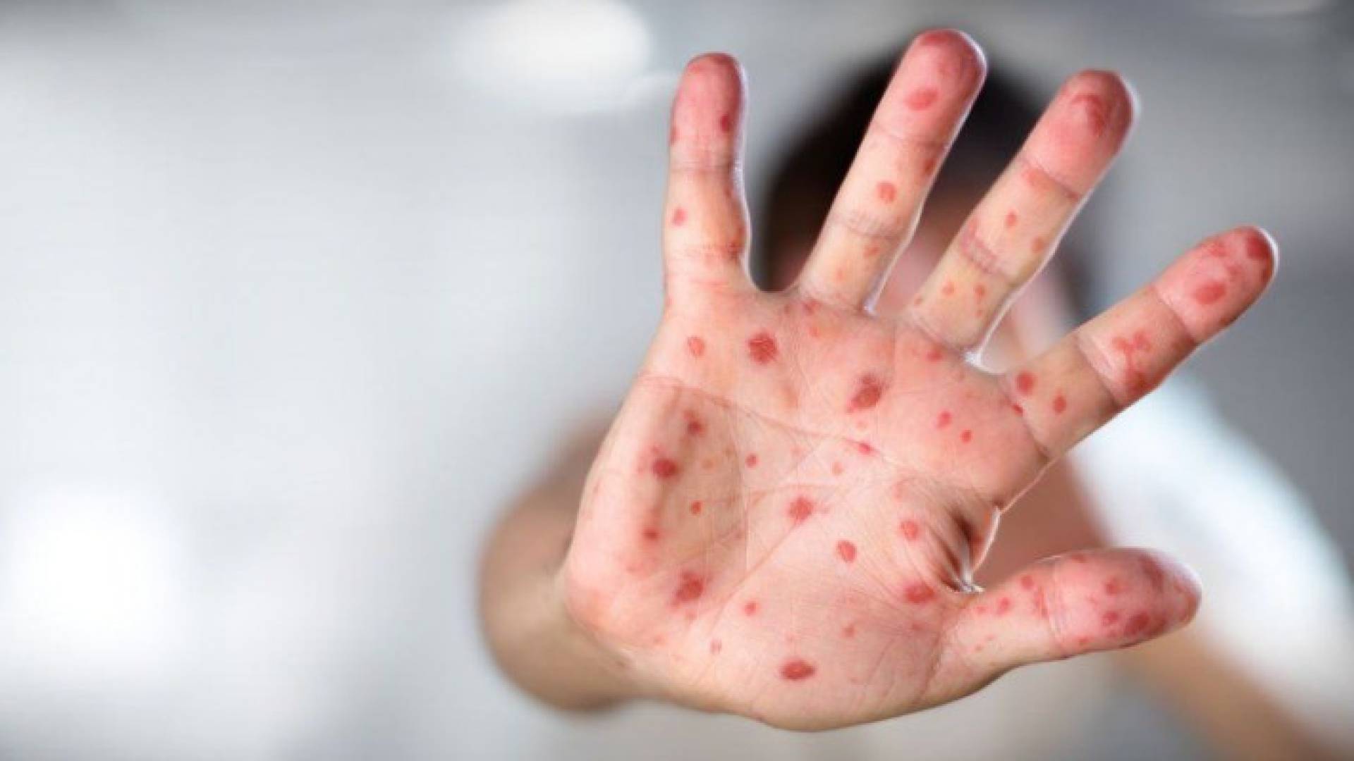 Image 1 from gallery