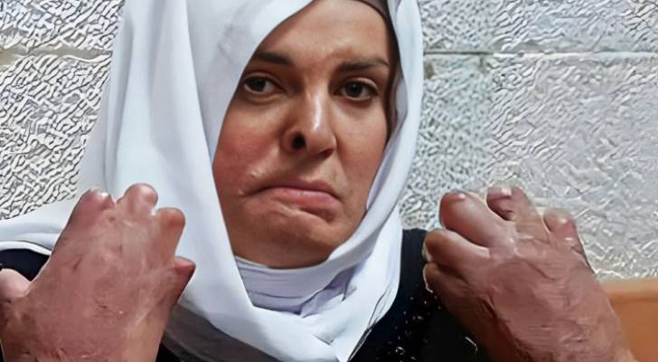 Family of Israa Jaabis awaits confirmation of her release today