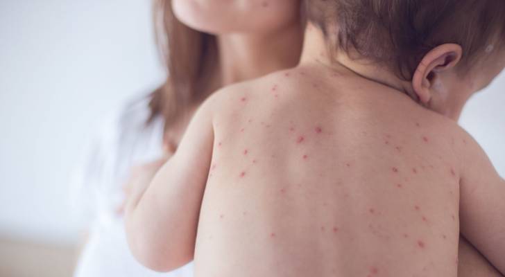 Roya News | Deadly disease breaks out in ‘Israel’, claims lives of eight so far: Hebrew media Roya News | Deadly disease breaks out in ‘Israel’, claims lives of eight so far: Hebrew media