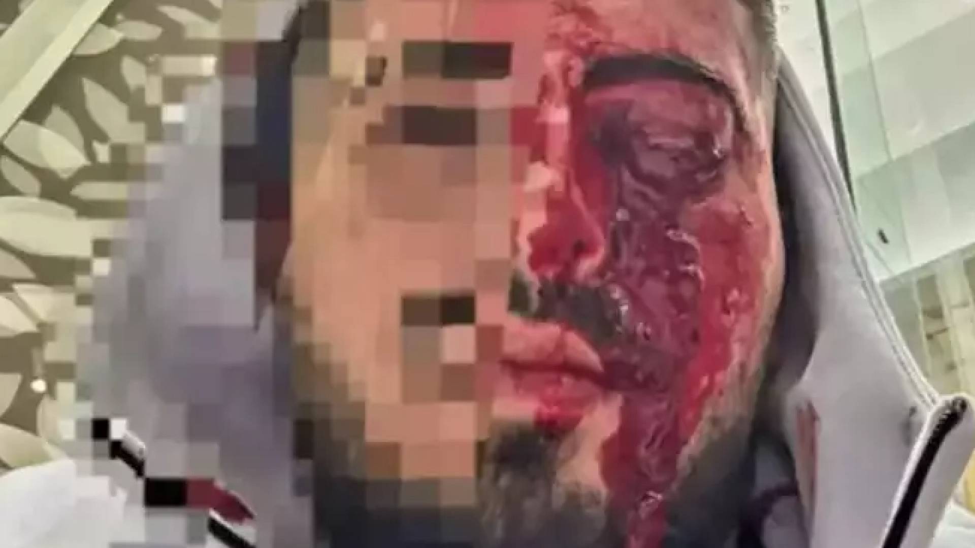 Image 1 from gallery