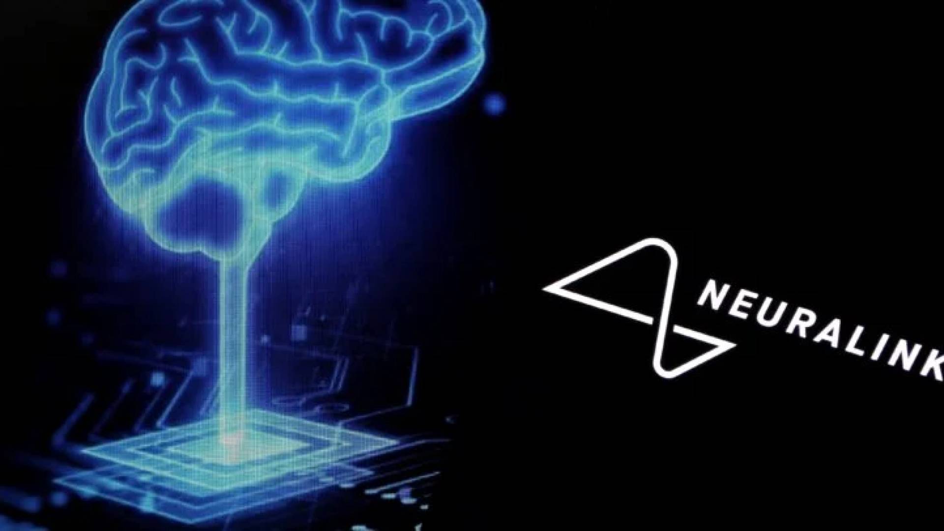 Neuralink to scale up brain chip production in 2026