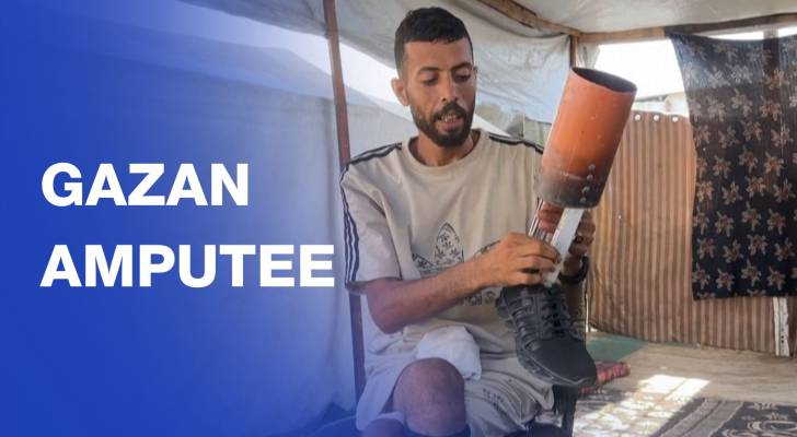 Gaza amputee makes prosthetic leg after aid site injury