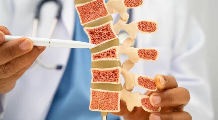 بديلاً للكولاجين.. باحثون ينجحون في ترميم العظام باستخدام "صوف الأغنام" 