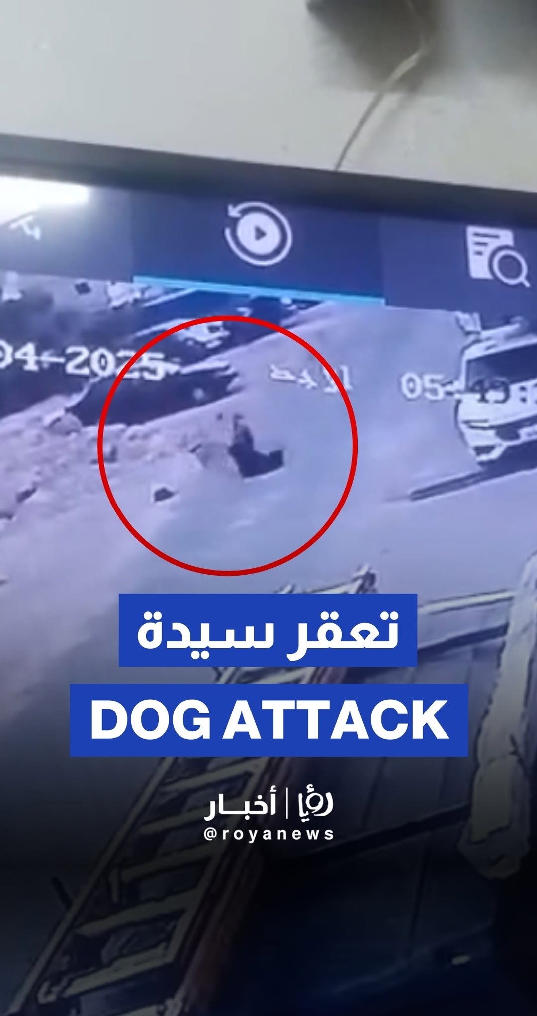 Dogs attack woman on street