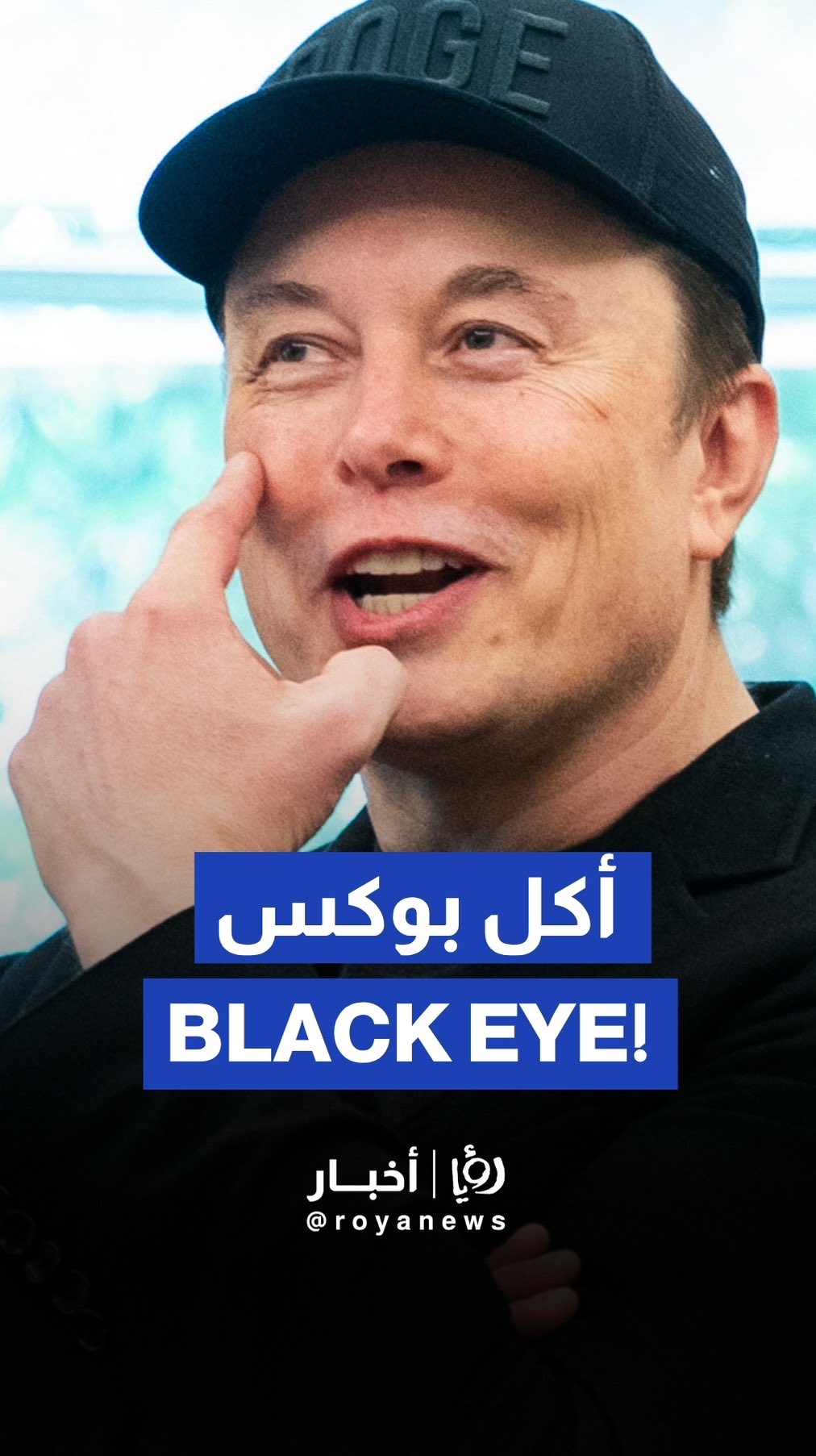 Musk says son X gave him black eye in playful moment