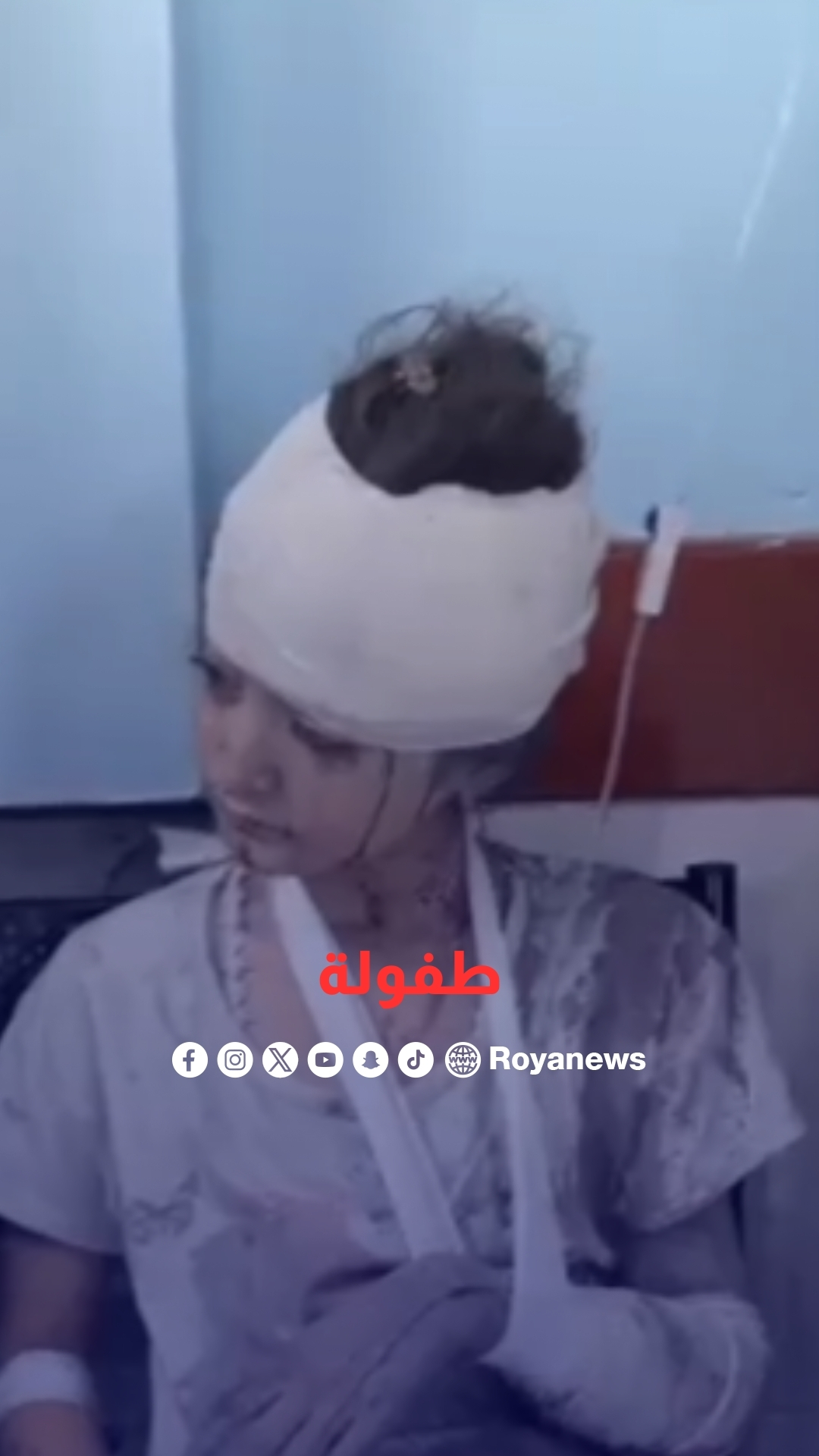 طفلة أُصيبت في قصف الاحتلال لمنازل شرق مدينة خان يونس