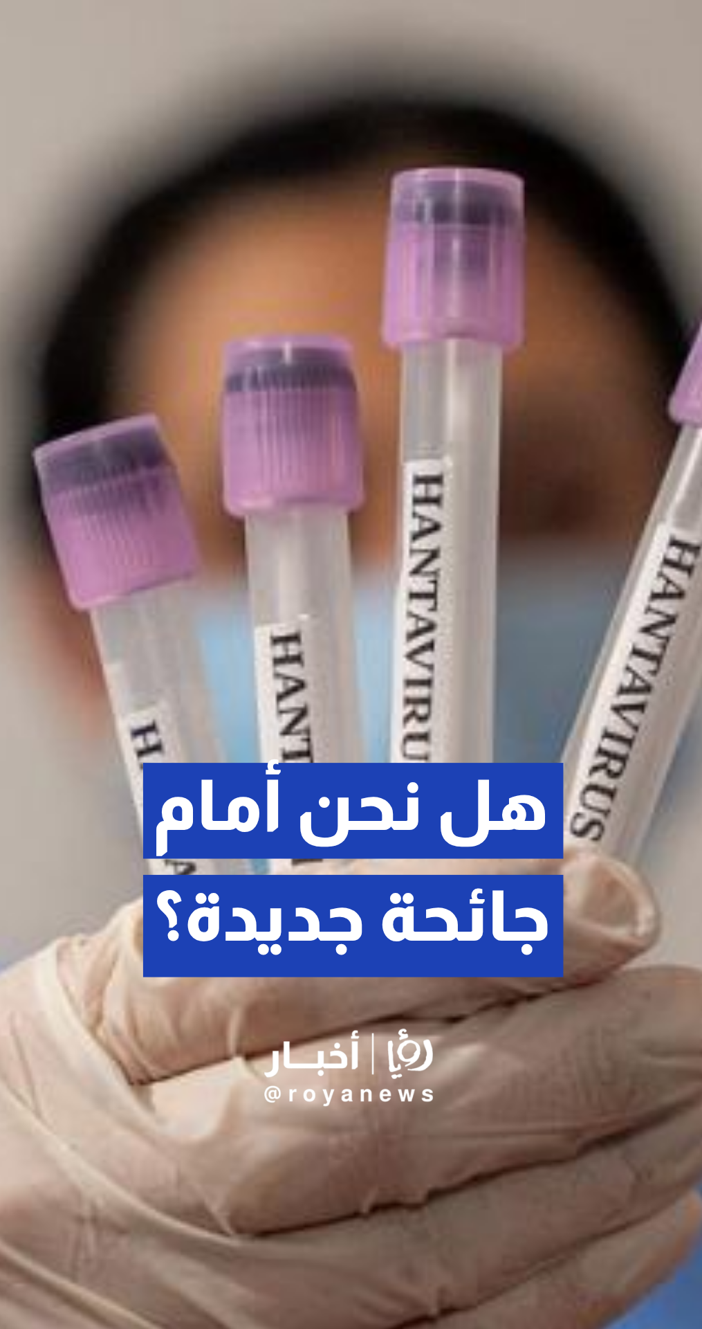 الطراونة: انتقال فيروس هانتا بين البشر "حالة نادرة" ولا يدعو للقلق العالمي