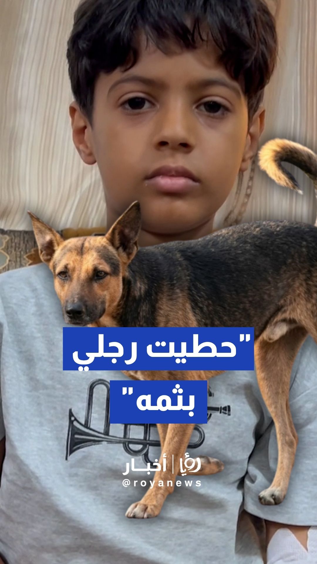 كلب ضال يعقر طفلا في مادبا